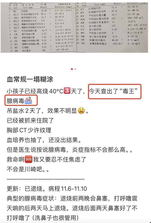 杭州腺病毒进入高发期 警惕高传染性