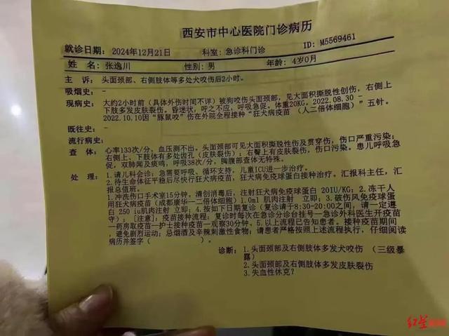 西安发生一起恶犬伤人事件，4岁男童耳朵被咬掉！仍在ICU昏迷