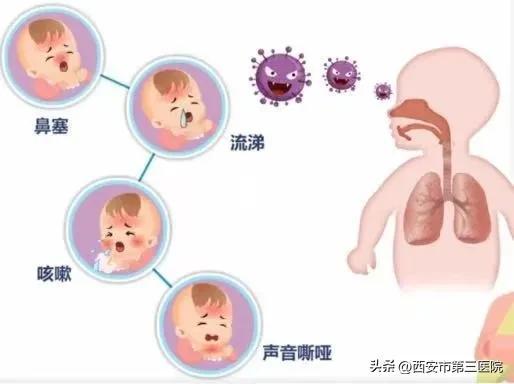 人偏肺病毒如何传播 冬季儿童易感